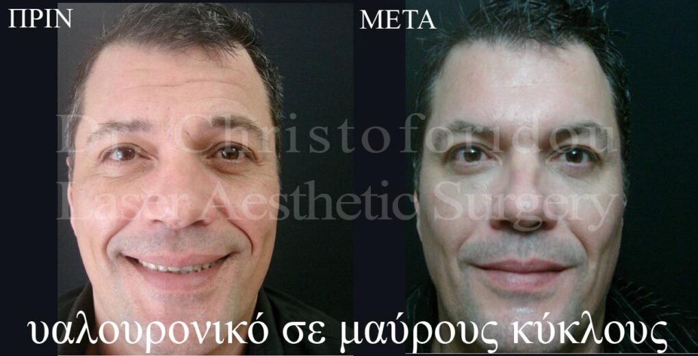 yalouroniko4 yalouroniko4
